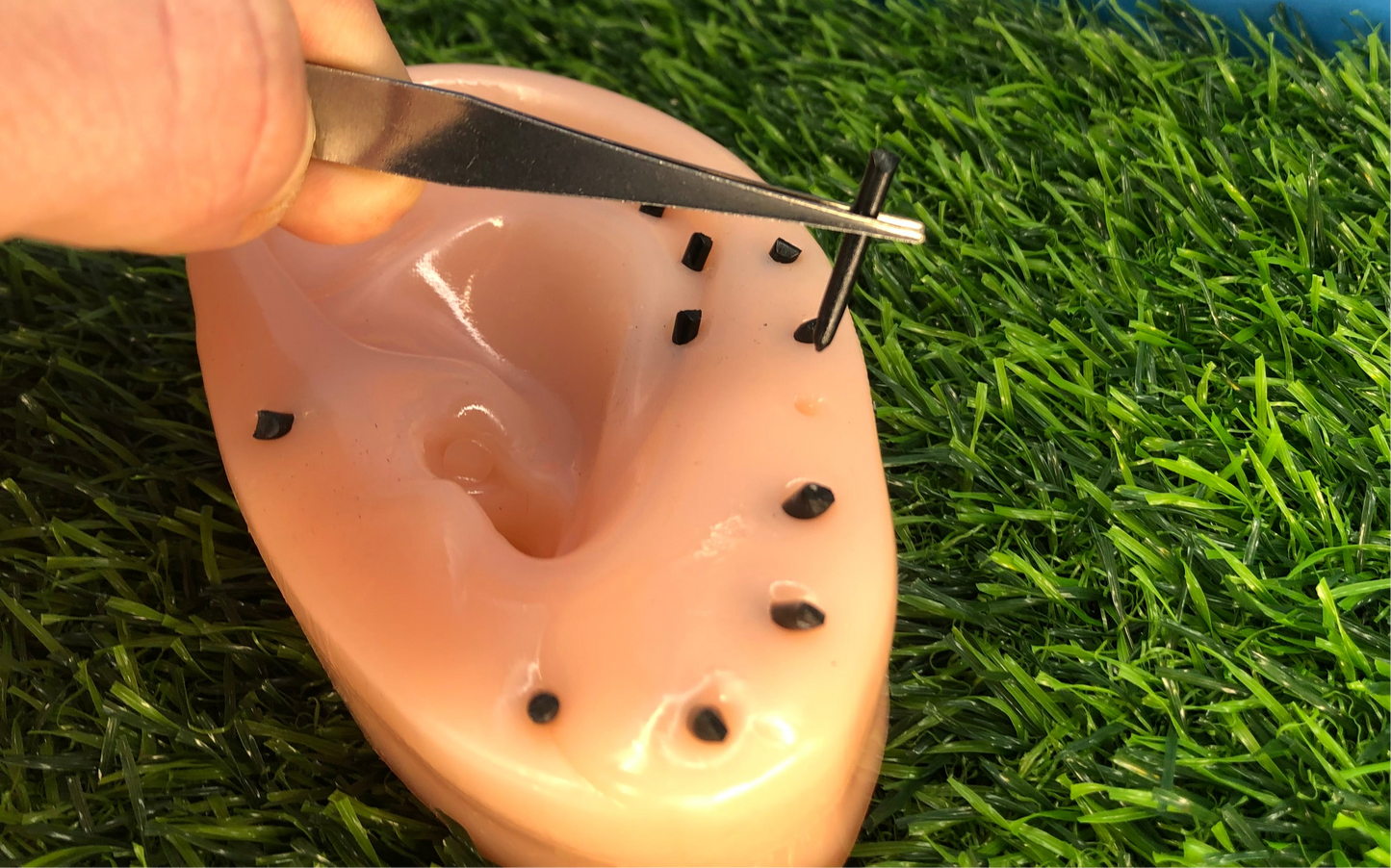 Blackhead Spot Popper Ear Fidget